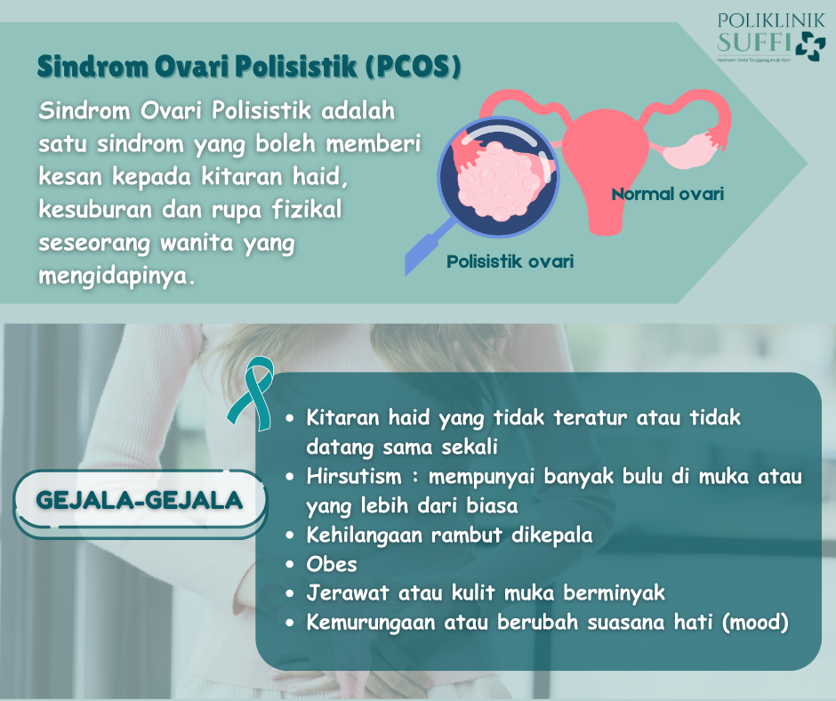 Sindrom Ovari Polistik (PCOS)