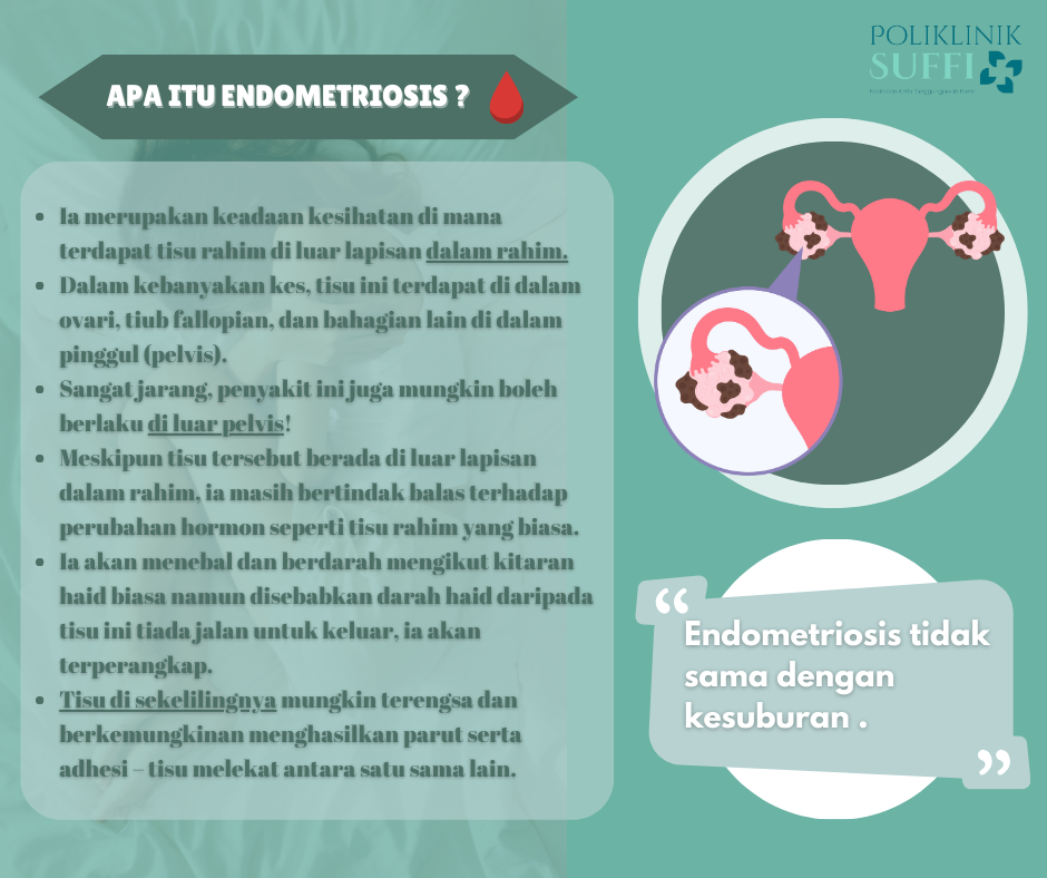 endometriosis